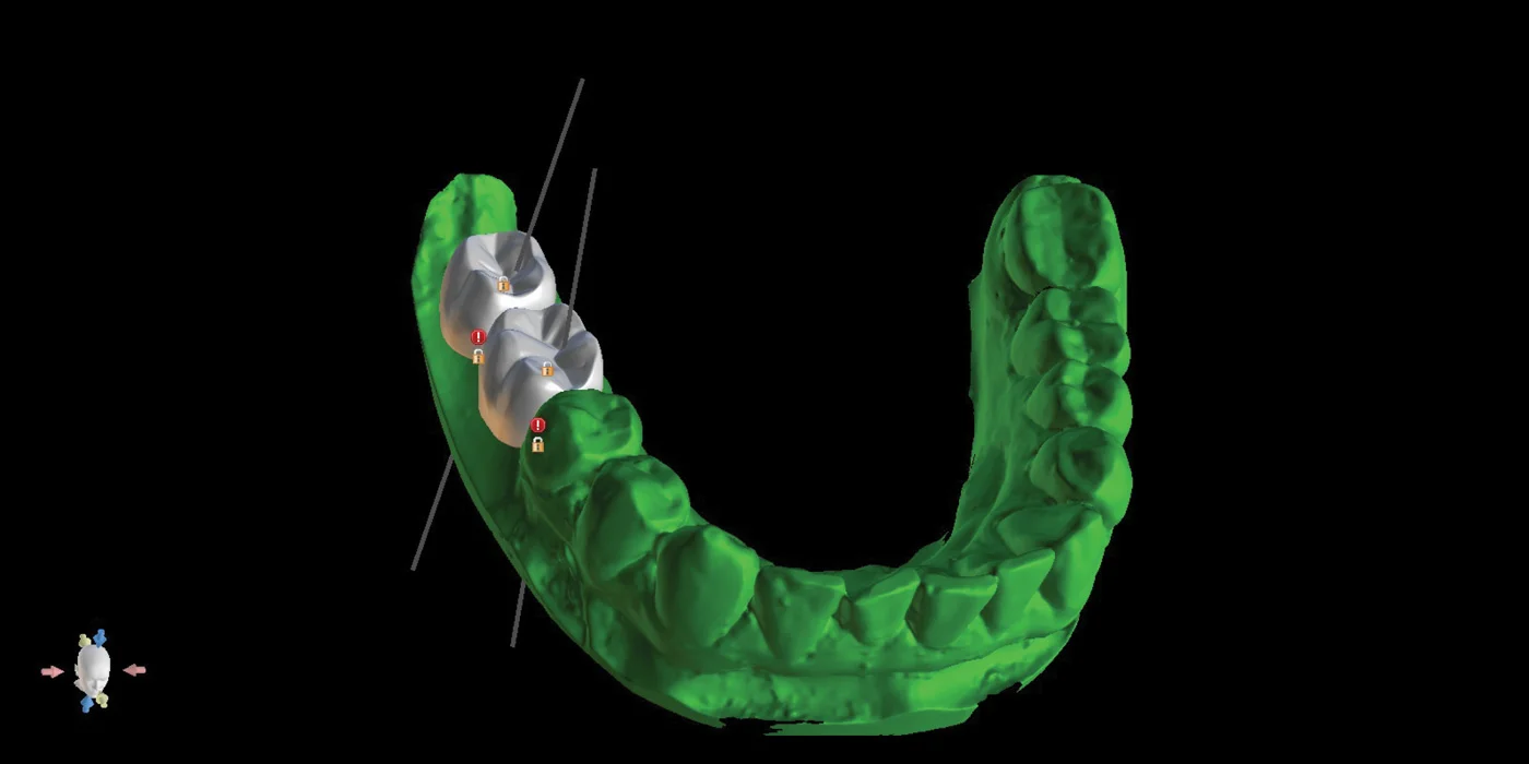 Stomatologia cyfrowa – z korzyścią dla pacjenta i lekarza