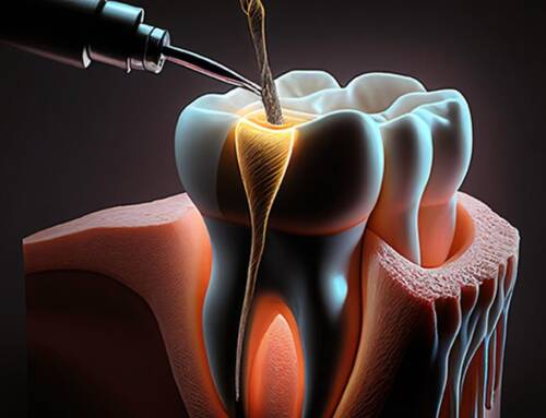 Endodoncja  – na czym polega nowoczesne leczenie kanałowe pod mikroskopem?