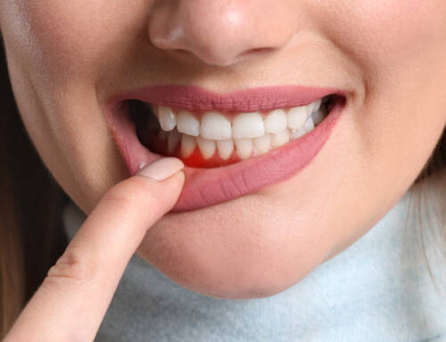 Czym jest periodontologia? Nowe spojrzenie na zdrowie jamy ustnej